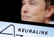 Brain Chip